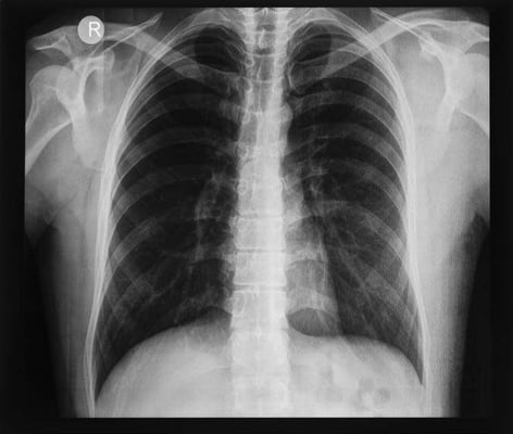 xraypic3-1
